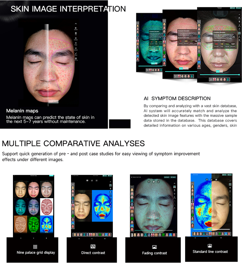 skin analyzer,skin analyzer machine,skin analyzer machine facial,3d skin analyzer,ai skin analyzer,facial skin analyzer,mobile skin analyzer,wood lamp skin analyzer,facial scanner skin analyzer,face scanner skin analyzer