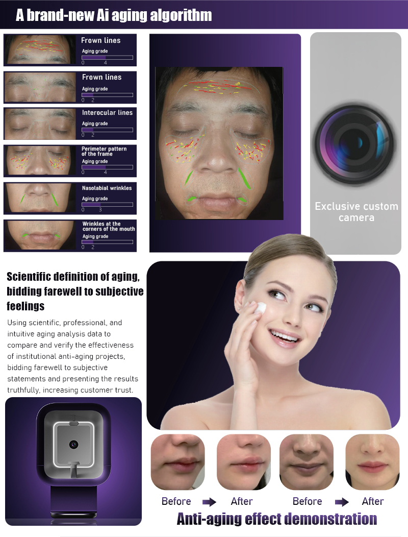 skin analyzer,skin analyzer machine,skin analyzer machine facial,3d skin analyzer,ai skin analyzer,facial skin analyzer,mobile skin analyzer,wood lamp skin analyzer,facial scanner skin analyzer,face scanner skin analyzer