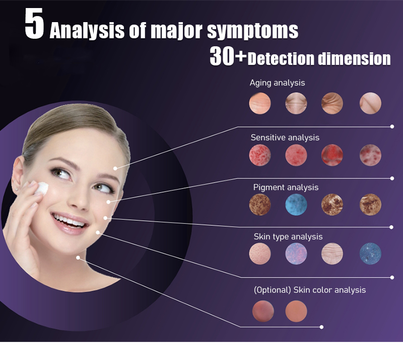 5 spectrum High-precision Detect Intelligent analysis diagrams for 12 types of projects!