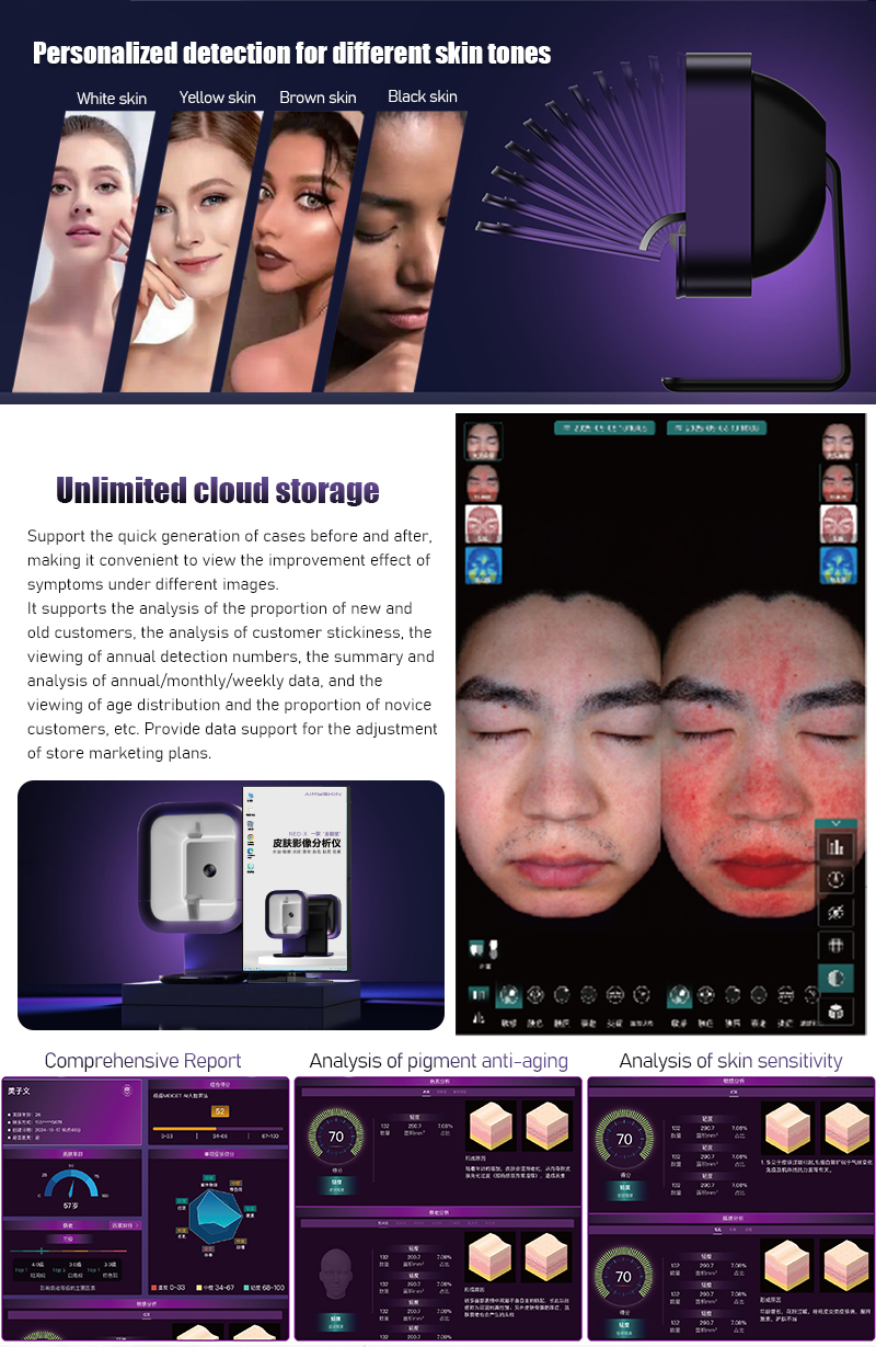 skin analyzer,skin analyzer machine,skin analyzer machine facial,3d skin analyzer,ai skin analyzer,facial skin analyzer,mobile skin analyzer,wood lamp skin analyzer,facial scanner skin analyzer,face scanner skin analyzer