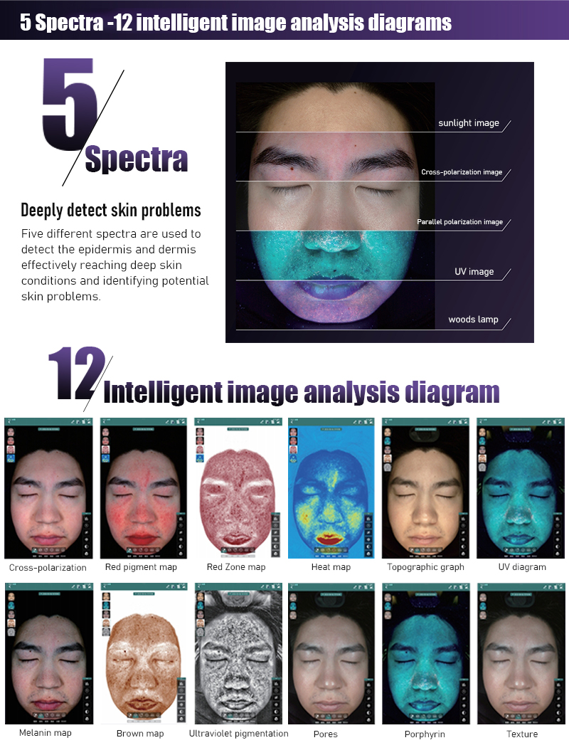 5 spectrum High-precision Detect Intelligent analysis diagrams for 12 types of projects!