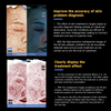 Professional AI 3D Skin Analyzer Facial Scanner 3D Skin Aanalysis Machine