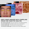 AIMYSKIN Radiant DX Skin Detector 3D Face Scanner Five Spectra Facial Care Intelligence Skin Test Analyzer
