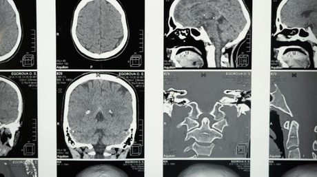 Ultrasound vs MRI vs CT Scan.png