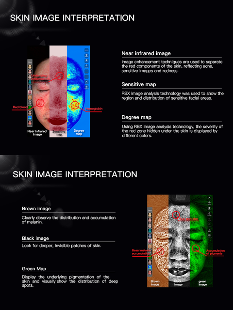 White Wholesale 3d Ios Ai Intelligent Skin Analyzer for Spa