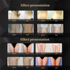 Slimming Machine
