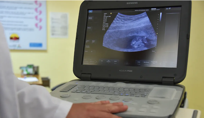 What Is Ultrasound and How Does It Work.png