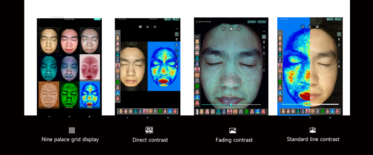 professional skin scanner