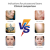Am-690 Professional Picosecond Laser Machine Pico Lazer Pigmentation Treatment Freckle Pigment Removal Pico Laser