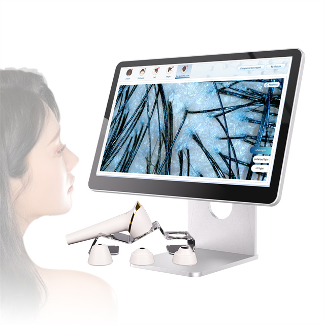Am-216 Portable Professional Facial Care Skin Detector AI Woods Lamp Skin And Hair Scalp Analyzer